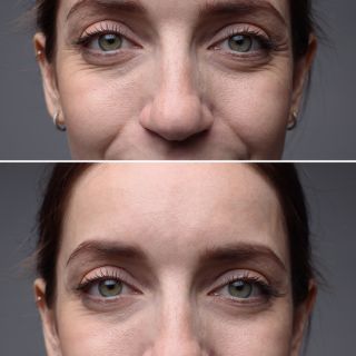 Supporto cosmetico contro le rughe visibili